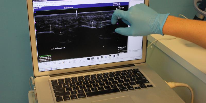 echografie podotherapie